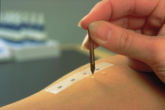 Allergie-Diagnostik - MVZ Benrath